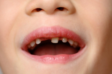 Child opens his mouth to show loose baby tooth and an erupting front permanent tooth next to it,...