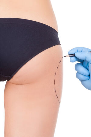 Preparation for hips improvement. Cropped image of female buttocks and doctors hand in protective glove sketching it while isolated on white backgroundの写真素材