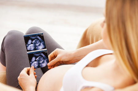 Pregnant woman with x-ray image. Top view of beautiful pregnant woman sitting on the chair and holding x-ray image of her babyの写真素材
