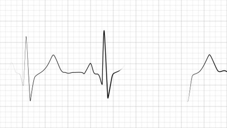 Dynamic heart rate or heart beat line. Cardiogram signal. Monochrome, black and white colors. Patient's vital signs. Pulse measuring. Medical. 3D renderingの写真素材