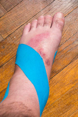 Elastic therapeutic tape (Kinesio Taping) on the left leg of the man.の写真素材