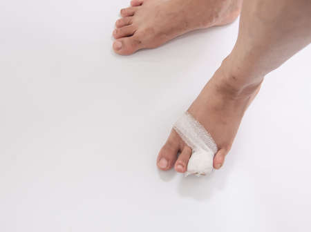 Man with broken leg and bandage on white background, closeupの写真素材