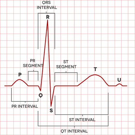 Human heart normal sinus rhythm, electrocardiogram record. Medical illustration.のイラスト素材