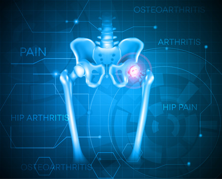 Human pelvis hip pain, abstract blue background. Hip arthritisのイラスト素材