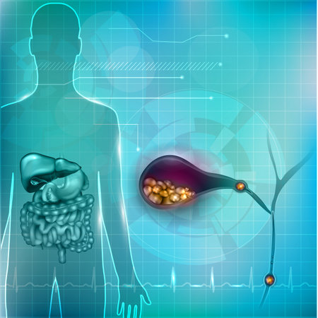 Stones in the Gallbladder and human silhouette with surrounding organs bright detailed illustration on an abstract technology mesh background and light cardiogramのイラスト素材