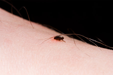a flea bites a person sitting on his skinの写真素材