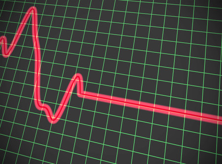 3D graph line on grid, fluctuating then flat. Distorted perspective.