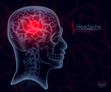 Headache, x-ray of the brain, vector illustration for medicine. A skull frame, A creative creative illustration in a new style of 2018のイラスト素材