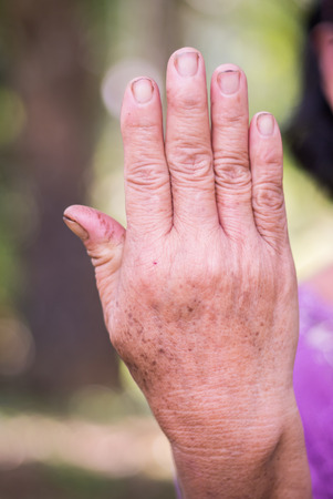 Back hand of old asian woman with bokeh backgroundの写真素材