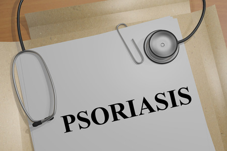 Render illustration of Psoriasis Title On Medical Documentsの写真素材