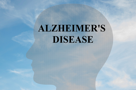 Render illustration of "ALZHEIMER'S DISEASE" title on head silhouette, with cloudy sky as a background.の写真素材