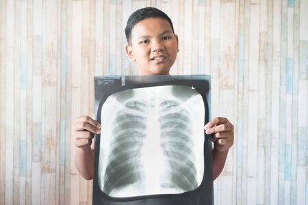 Young teen holding his x-ray film. Concept of health careの写真素材