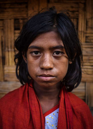 COX' BAZAR, BANGLADESH - MARCH 16, 2019 : Face of Rohingya refugees from Myanmar waiting for food...