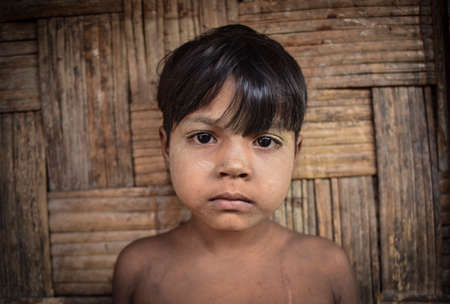 COX' BAZAR, BANGLADESH - MARCH 16, 2019 : Face of Rohingya refugees from Myanmar waiting for food...