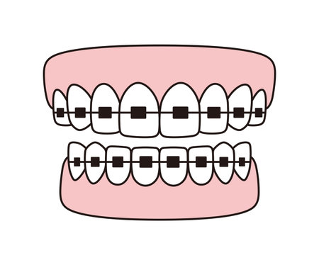 Teeth braces icons, Vector flat illustrationのイラスト素材