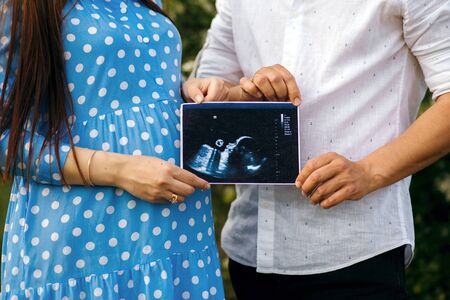 Happy young couple holding ultrasound of their baby in hands, future parentsの写真素材