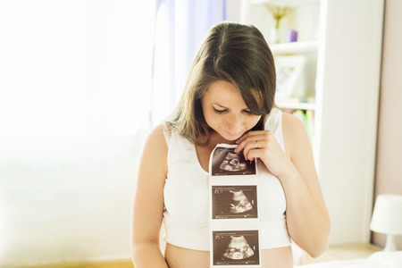 Beautiful pregnant woman holding ultrasound scan pictureの写真素材