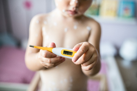 Unrecognizable little two year old girl at home sick with chickenpox, white antiseptic cream applied to the rash, holding thermometer, showing temperature. Close up.の写真素材
