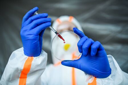 Unrecognizable doctor with blood sample in hospital, coronavirus concept.の写真素材