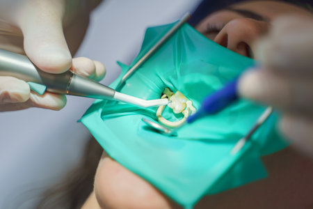 Close-up of dental examination in the ambulance.の写真素材