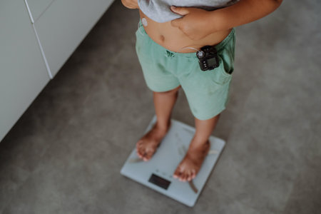 A young boy with diabetes weighing himself on bathroom scale.の写真素材