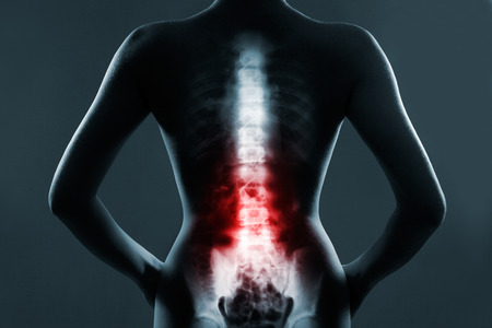 Human spine in x-ray, on gray background. The lumbar spine is highlighted by red colour.の写真素材