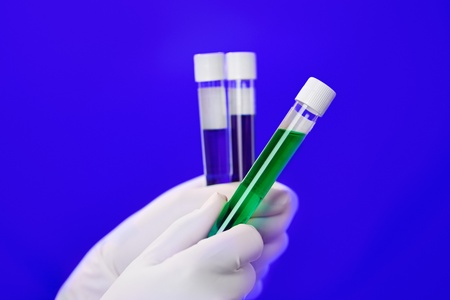Medical test tubes with fluid sample closeup in gloved hand on blue background