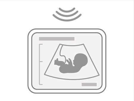 Ultrasound examination procedure. Baby in womb. Pregnancy and health of child. 

Embryo and umbilical cord on screen.  Medical symbol for pregnancy center. 
Vector illustrationのイラスト素材