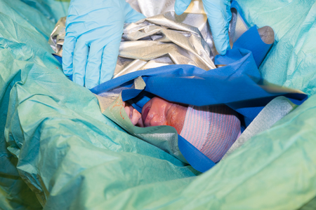 ENSCHEDE, NETHERLANDS - JUNE 7, 2017: Newborn baby girl delivered with a cesarian sectionのeditorial素材