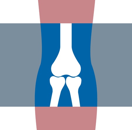 Radiology, x-ray, armの写真素材