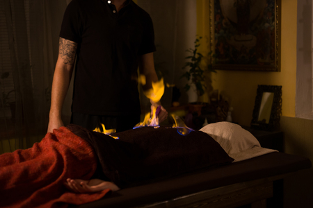 Chinese fire massage - Huo Liao therapy. Traditional chinese medicine, fire treatment and bodycare conceptの写真素材