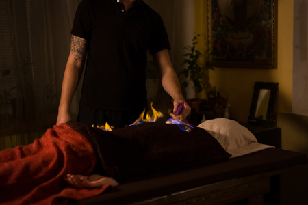 Chinese fire massage - Huo Liao therapy. Traditional chinese medicine, fire treatment and bodycare conceptの写真素材
