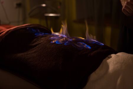 Chinese fire massage - Huo Liao therapy. Traditional chinese medicine, fire treatment and bodycare conceptの写真素材