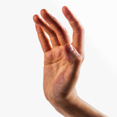 Female's hand with very dry skin. Painful cracks on fingers. Eczema or dermatological problems...