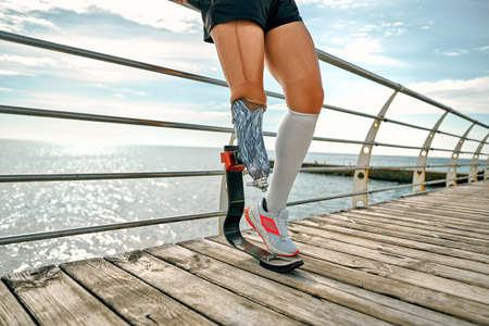 Cropped image of disabled young woman in sportswear with bionic leg standing on a bridge in front of the sea.の写真素材