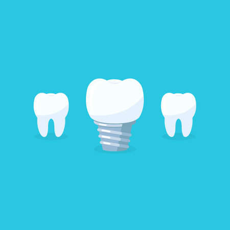 Teeth with dental implant icons on blue background. Tooth symbol of dent clinicのイラスト素材
