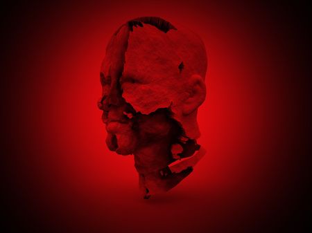 An image of a skin peeling face.の写真素材