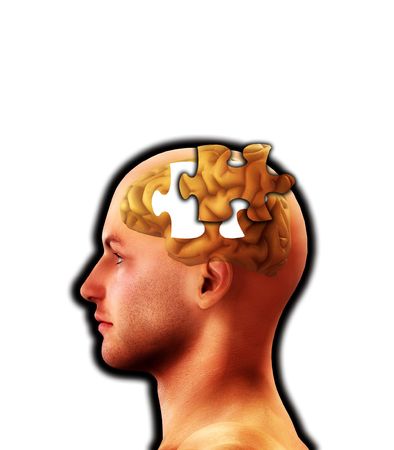 A conceptual image representing memory loss and alzheimers.の写真素材