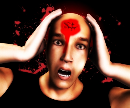 Man with a very terribly bad head wound on his forehead.
 の写真素材