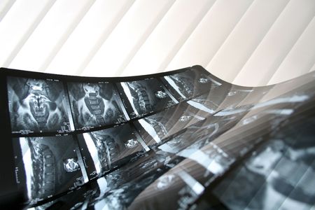 x-ray