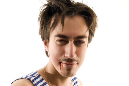  young man with his mouth bleedingの写真素材