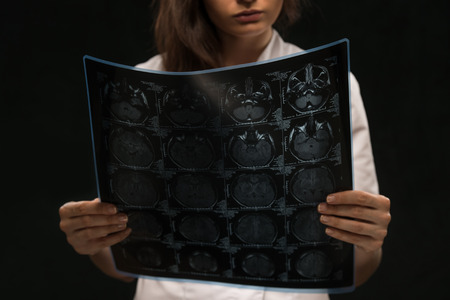 Doctor viewing mri x-ray of brainの写真素材