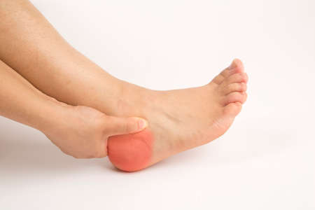 foot heel pain woman and isolated backgroundの写真素材