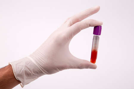 blood tubes white background, virus blood test,pandemicの写真素材