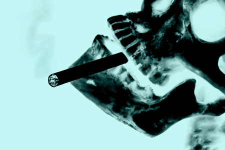 Smoking kills or Stop smoking conceptual image with x-ray imageの写真素材
