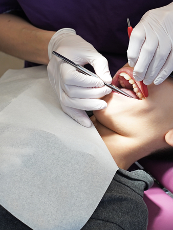 Dentist examining little boy's teeth in clinicの写真素材