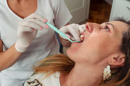 Young Dentist checking the mouth of a beautiful female patient. Concept dental care, health care.の写真素材