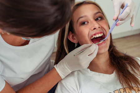 Young teenage girl with her mouth open for the dentist to check her teeth. concept of dental insurance, oral health, medical care.の写真素材
