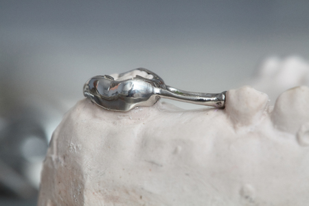 Gray dental prosthesis teeth mold, clay human gums model in jaws prothetic laboratoryの写真素材