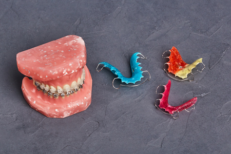 Human jaw or teeth model with metal wired dental braces, orthodontic presentation tool, closeupの写真素材